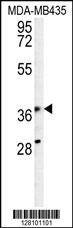 Anti-KPRA (N-term) Antibody