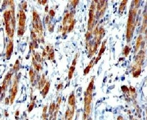 Anti-SMMHC Antibody