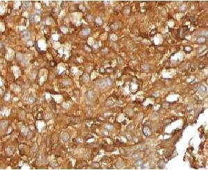 Anti-B2M Antibody, Sodium Azide Free