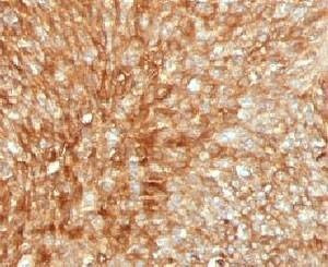 Anti-B2M Antibody, Sodium Azide Free