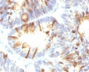 Anti-MUC2 Antibody