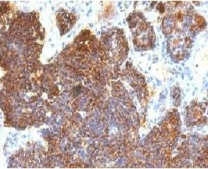 Anti-Parathyroid Hormone Antibody, Sodium Azide Free