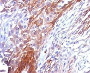 Anti-Cytokeratin 17 Antibody