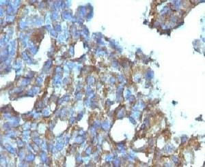 Anti-CD99 Antibody, Sodium Azide Free
