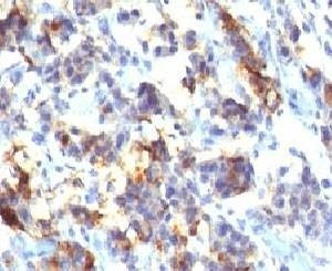 Anti-MUC5AC Antibody