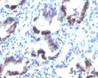 Anti-SM22 alpha Antibody, Sodium Azide Free