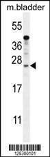 Anti-KIAA1644 (N-term) Antibody