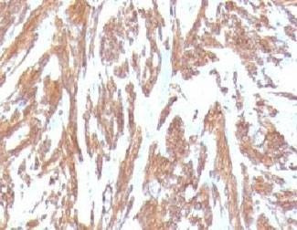 Anti-Smooth Muscle Actin Antibody
