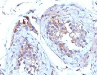 Anti-SHBG Antibody
