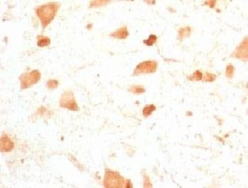 Anti-PGP9.5 Antibody