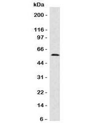 Anti-Fascin Antibody