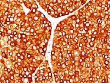Anti-Tyrosinase Antibody, Sodium Azide Free