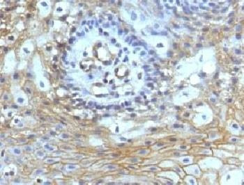 Anti-CD59 Antibody, Sodium Azide Free