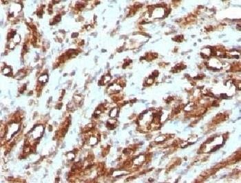 Anti-Muscle Actin Antibody