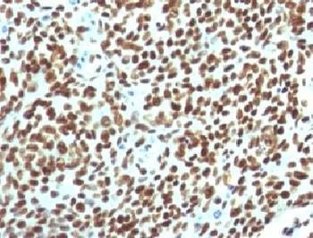 Anti-Nuclear Antigen Antibody, Sodium Azide Free