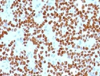 Anti-NKX2.2 Antibody