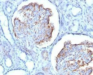 Anti-WT1 Antibody, Sodium Azide Free