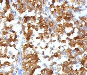 Anti-MART-1 Antibody, Sodium Azide Free
