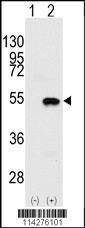 Anti-SMYD2 (N-term) Antibody