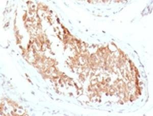 Anti-ALDH1 Antibody, Sodium Azide Free