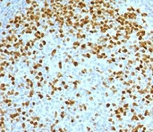 Anti-Topoisomerase II alpha Antibody, Sodium Azide Free