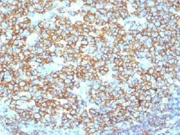 Anti-CD20 Antibody