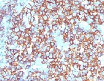 Anti-CD20 Antibody