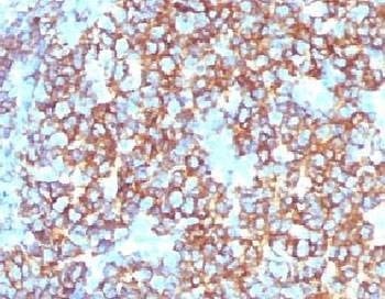 Anti-CD20 Antibody, Sodium Azide Free