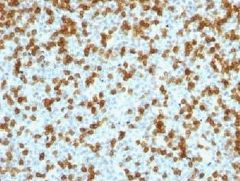 Anti-PDCD1 / PD-1 Antibody