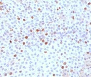 Anti-TOP2A Antibody, Sodium Azide Free