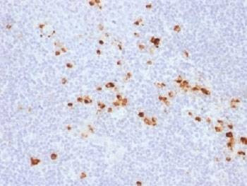 Anti-IgG Heavy Chain Antibody