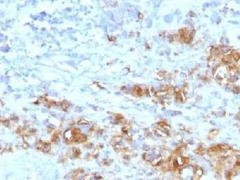 Anti-CA19-9 Antibody