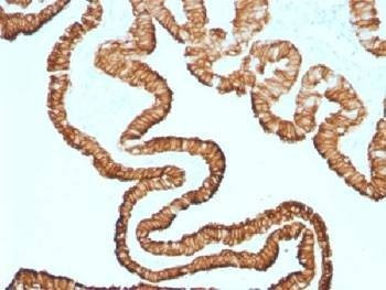 Anti-Cytokeratin 7 Antibody, Sodium Azide Free