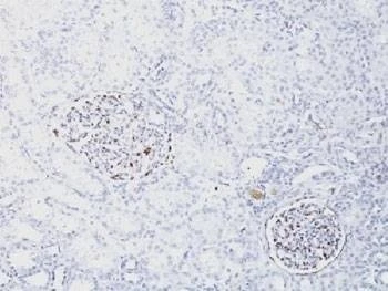 Anti-WT1 / Wilms Tumor 1 Antibody