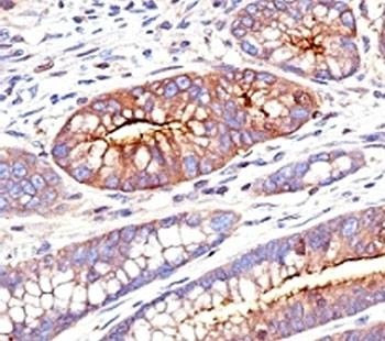 Anti-CEA Antibody, Sodium Azide Free