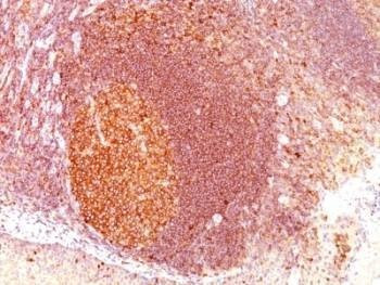 Anti-MALT1 Antibody, Sodium Azide Free