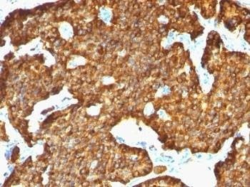 Anti-Chromogranin A Antibody, Sodium Azide Free