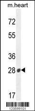 Anti-B3GAT2 (Center) Antibody