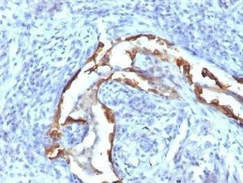 Anti-Cytokeratin 8 Antibody, Sodium Azide Free