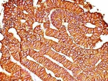 Anti-EpCAM Antibody, Sodium Azide Free
