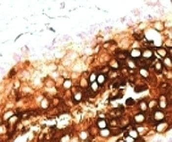 Anti-Cytokeratin 17 Antibody, Sodium Azide Free