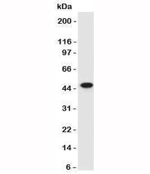 Anti-Cytokeratin 17 Antibody, Sodium Azide Free