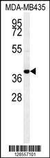 Anti-CCR8 (C-term) Antibody