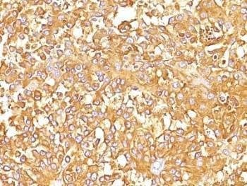 Anti-gp100 Antibody, Sodium Azide Free