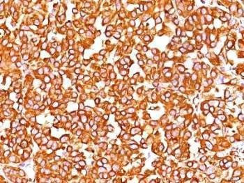 Anti-VIM Antibody, Sodium Azide Free