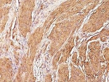 Anti-Muscle Specific Actin Antibody, Sodium Azide Free