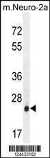 Anti-AP3S1 (N-term) Antibody