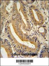 Anti-AP3S1 (N-term) Antibody