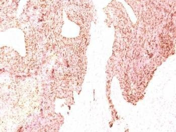 Anti-Chromogranin A Antibody, Sodium Azide Free