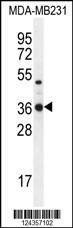 Anti-TPSD1 (C-term) Antibody